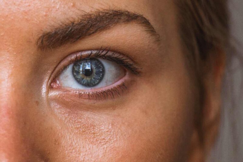 Was tun bei Schwellungen an den Augen?